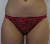 Mythica mini brief